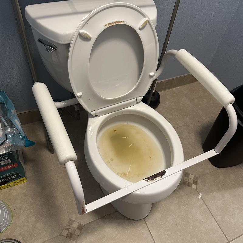 Toilet bowl with support rails and discolored water