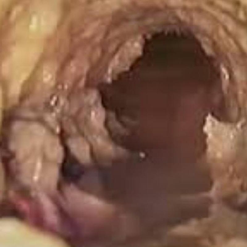 Main sewer line pipe with break and damage inside