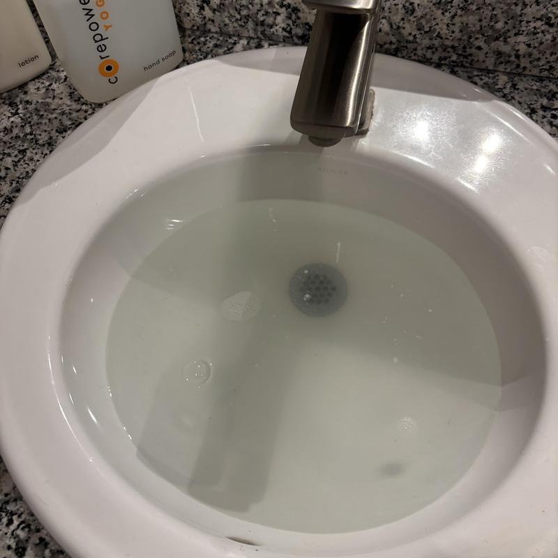 Bathroom sink filled with standing water from clog