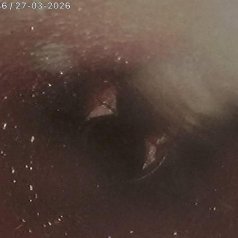 Clay sewer pipe offset visible in video inspection