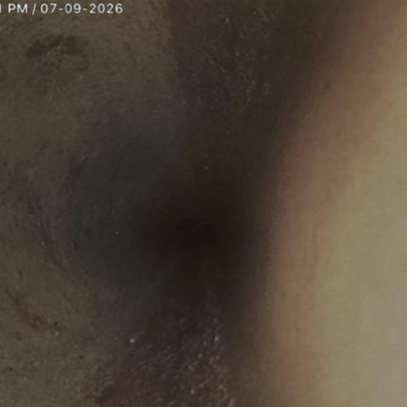 Sewerline camera inspection showing root intrusion Sewerline camera inspection showing root intrusion